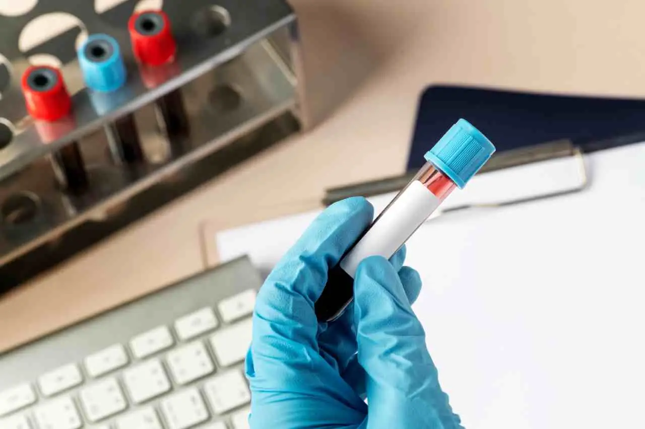 Attenzione: non serve digiunare per tutte le analisi del sangue. Ecco quando è davvero obbligatorio